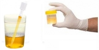 Echantillon d'urine, ure, carbamide, E927b, additif